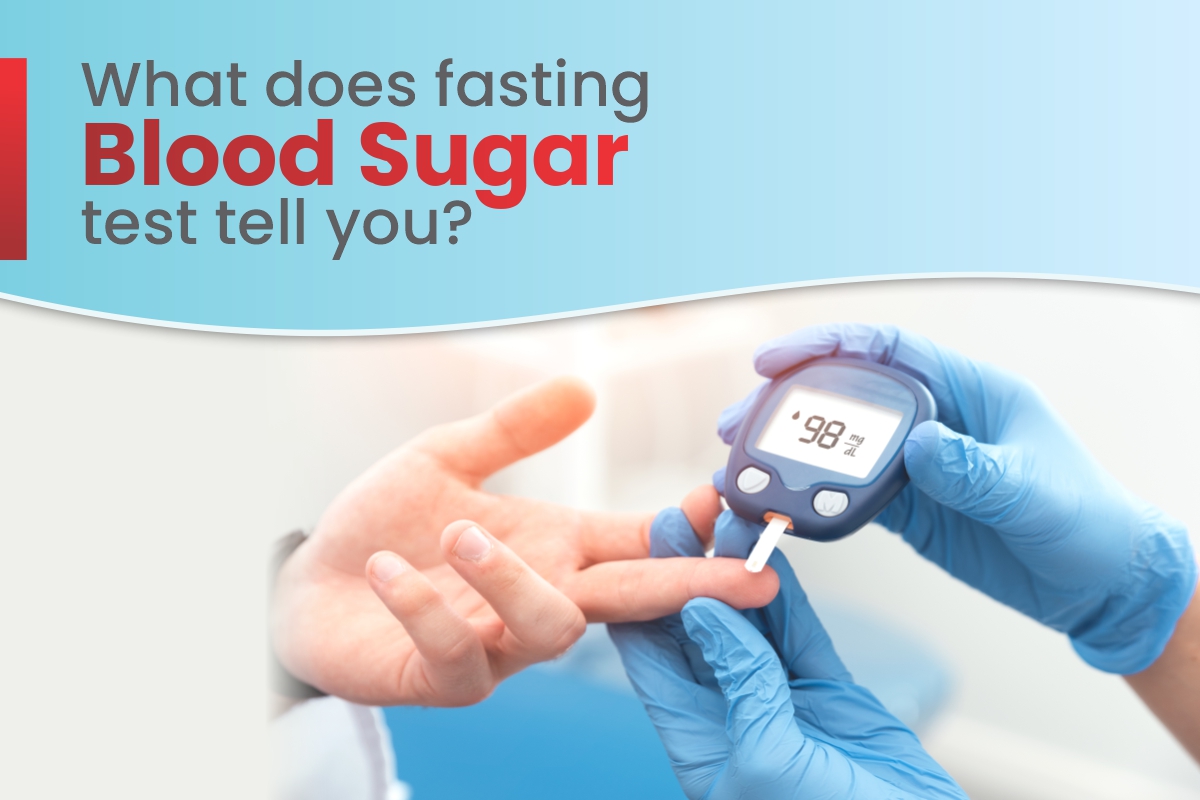 thumbnail image 2 of Do You Need To Fast For CBC Blood Test? - Centers Urgent Care 2 of 11